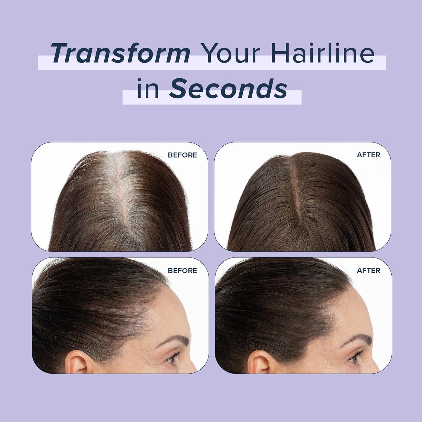 TRUHAIR Root & Scalp Cover Up Pressed Powder Compact, Waterproof, Weightless Hair Coverage & Bald Spot Concealing, Root Touch Up Hair Color for Gray Coverage & Thinning Areas, 0.35 Oz (Light Blonde)